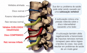 subluxacao